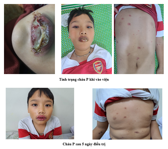 Hãy cẩn trọng khi dùng thuốc