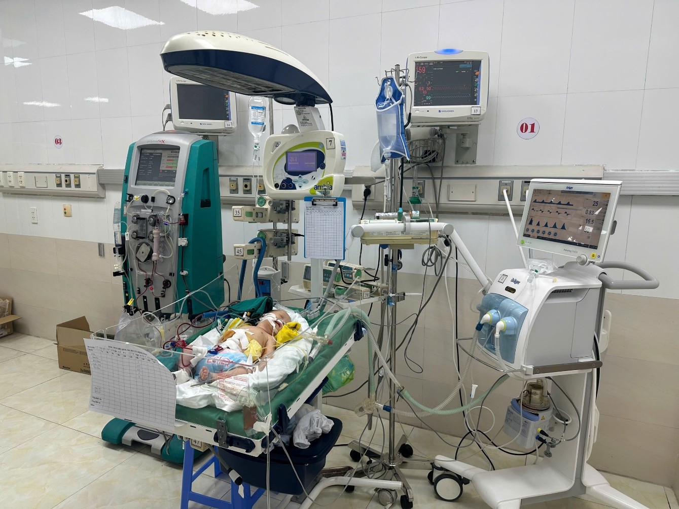 CA BỆNH THỰC HIỆN THÀNH CÔNG TẠI BỆNH VIỆN NHI HẢI PHÒNG LỌC MÁU LIÊN TỤC CỨU SỐNG CHÁU BÉ SƠ SINH SỐC NHIỄM KHUẨN DO VIÊM PHÚC MẠC THỦNG RUỘT