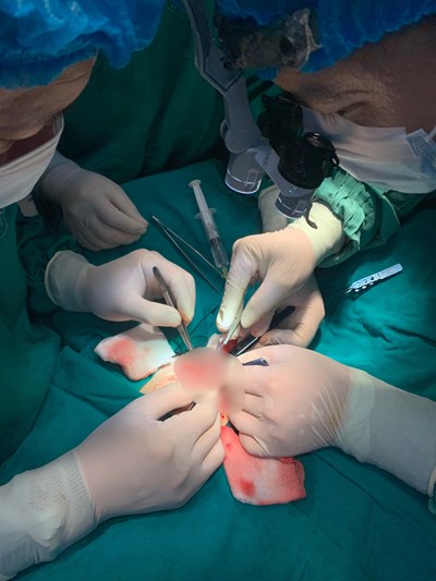 PHẪU THUẬT THÀNH CÔNG BỆNH NHÂN ĐỨT RỜI DƯƠNG VẬT TẠI BỆNH VIỆN NHI HẢI PHÒNG